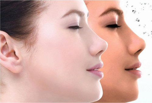 化妆品中的“美白素”，就是你激素脸的病源！