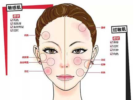 欲知敏感肌肤与激素脸的差异，这四项必看！